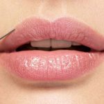 lip filler treatment